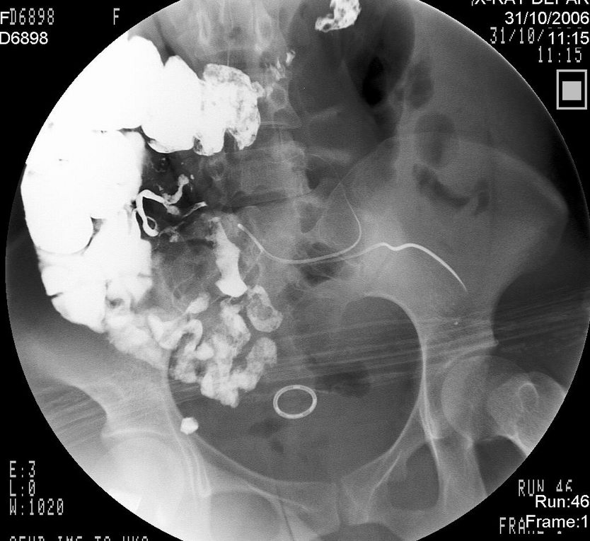 ���Ƴ��׳没����Щ������