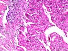 ���޶������ٴ���������Щ��