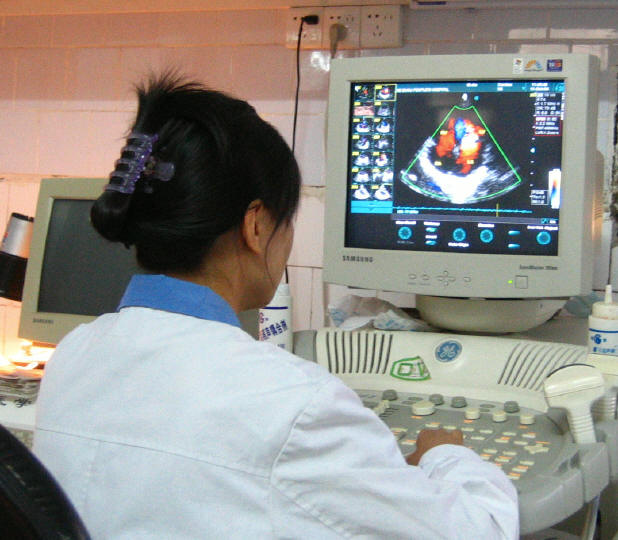 ����GE-Bθ���ʳ�