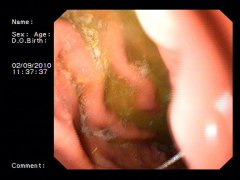 ������Ƶ�֭������θ�ױȽϺ�