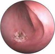 ����θ������ô��_����θ��ҽԺ�ĸ���