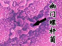 �����ݸ˾�