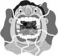 ʲô�����οڳ�